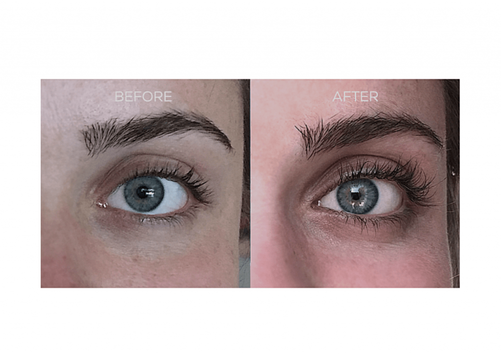 Nulastin Before After Reviews