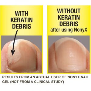 How To Use Nonyx Nail Gel?