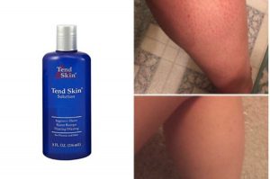 direct customer reviews of tend skin