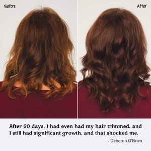 Hair La Vie before and after Photos