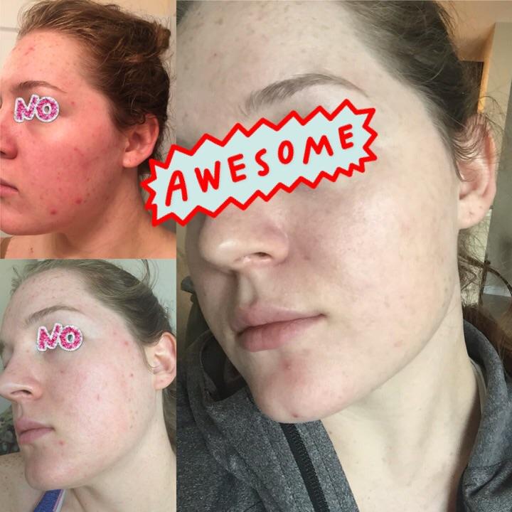 skinmedica before and after 