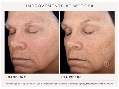 skinmedica tns serum before after