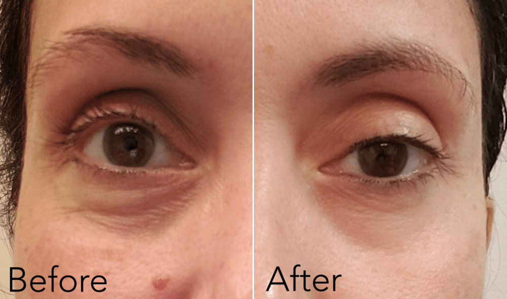 Before and After Eyes Eyes Baby Eye Cream
