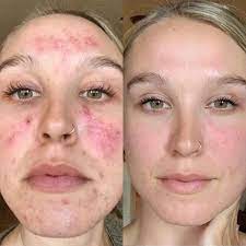 Face Reality Before and After