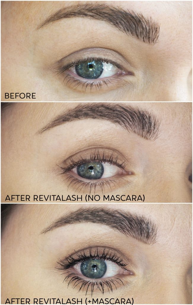 RevitaLash Before and After