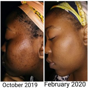 Urban Skin Rx Before and After