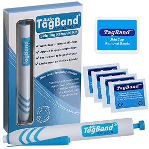 Auto Tagband