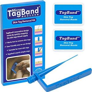 Tagband Skintag removal