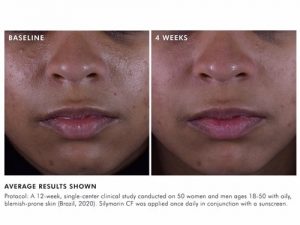 Skinceuticals Before and After