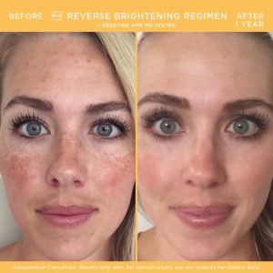 rodan and fields vs beautycounter before and after