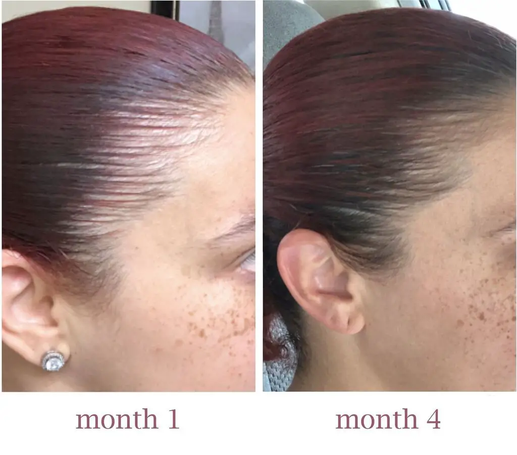 Camille Rose Cocoa Nibs Growth Serum before and after