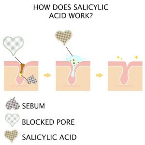 Salicylic Acid