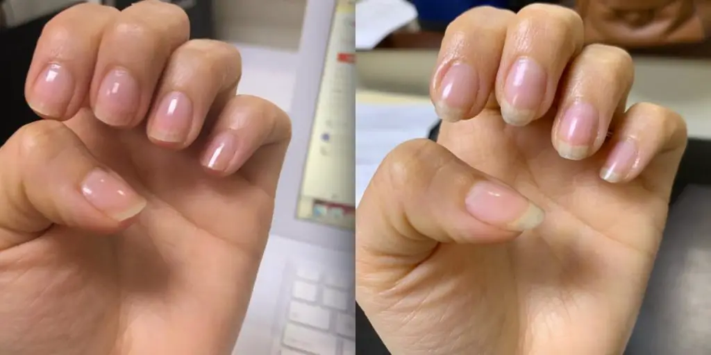 Hard As Hoof Nail Strengthening Cream before and after