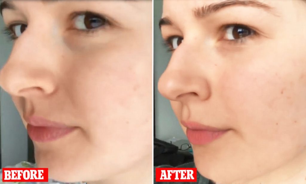 Pomegranate Repair Serum before and after