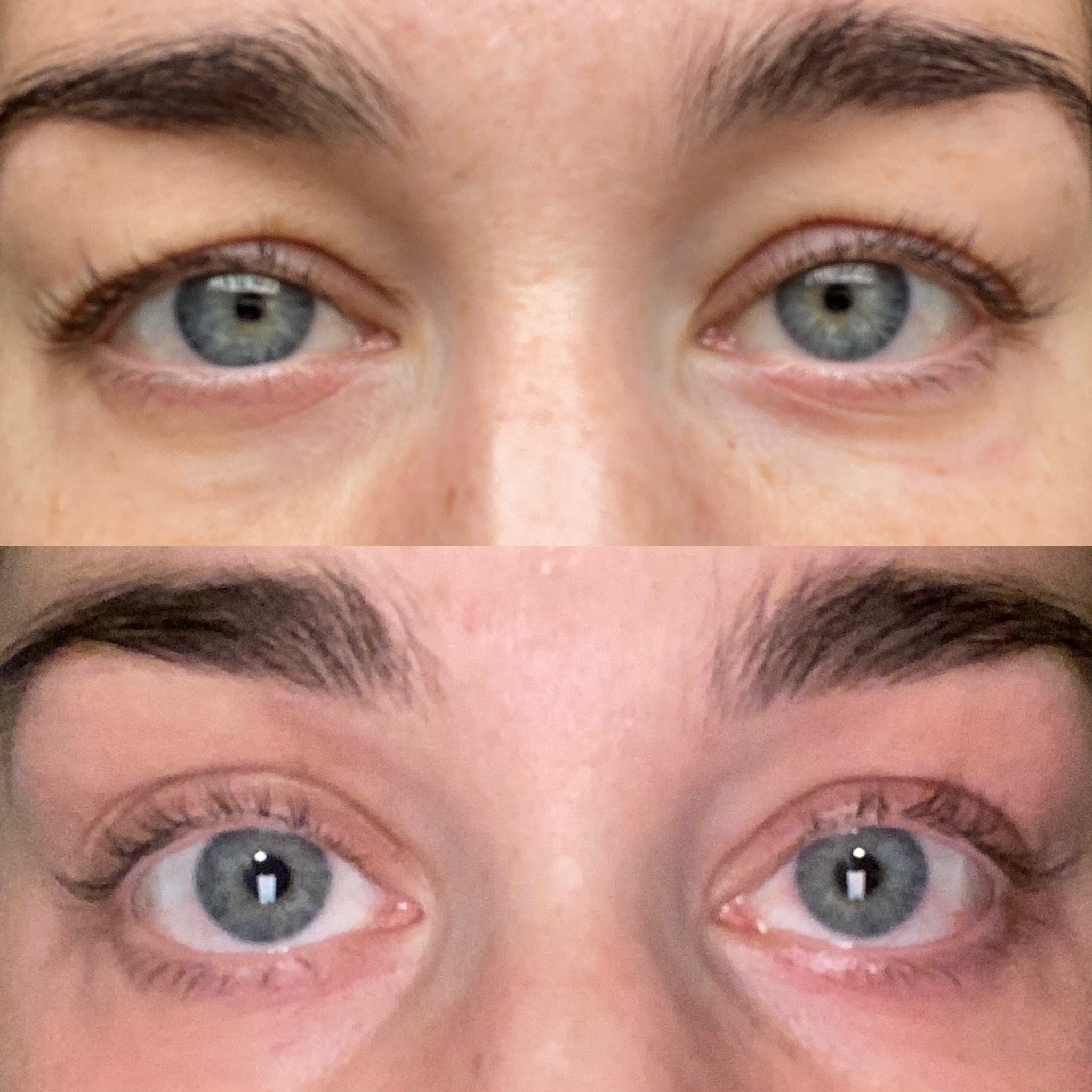 Verso Super Eye Serum Before and After