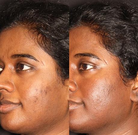 miami md total beauty matrix before and after