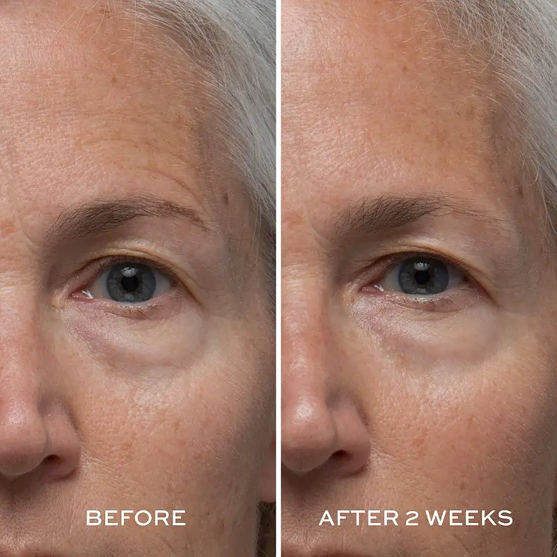 elemis before and after