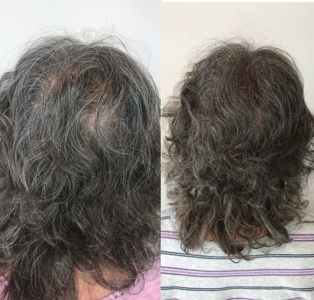 Aveda Invati Before and After