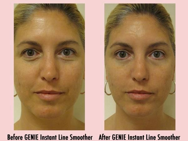 Genie Instant Line Smoother before and after