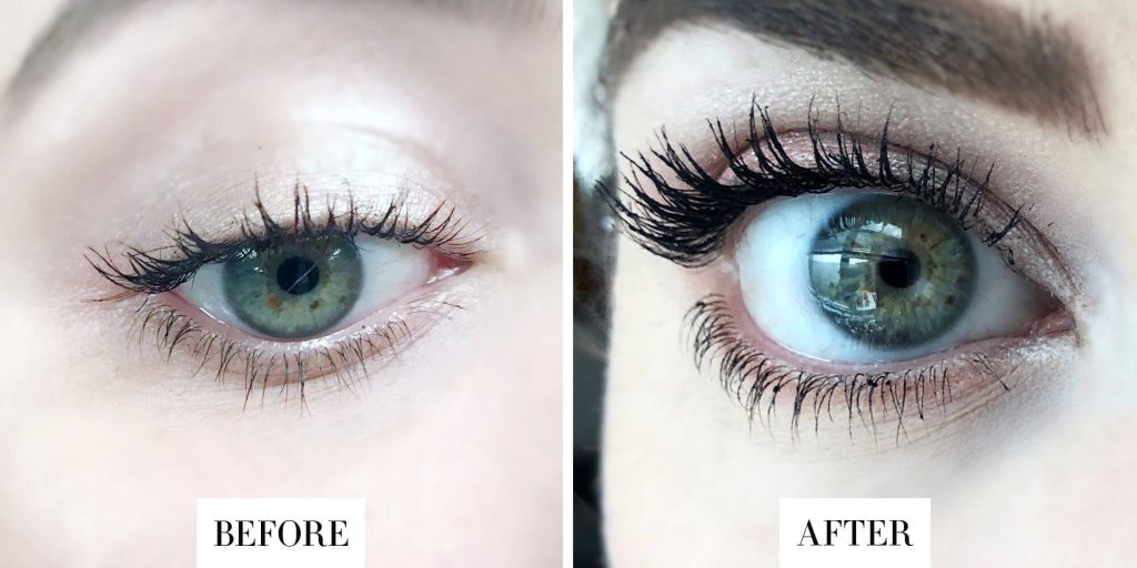 Neulash Before and After