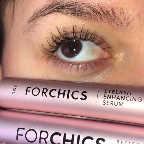 Forchics Reviews