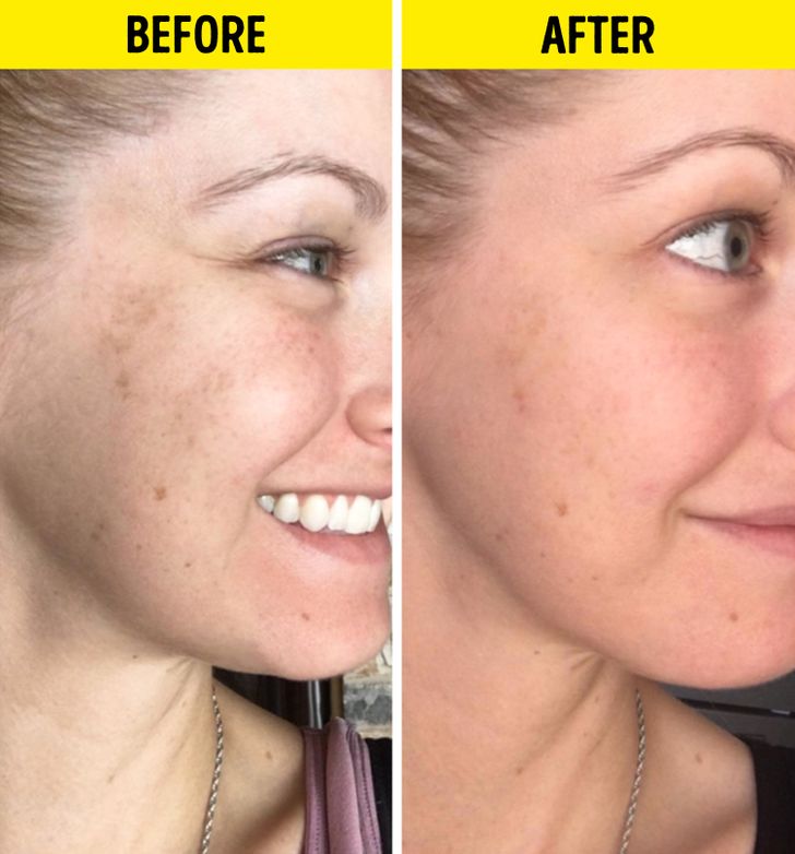 Scentuals Vitamin C Serum Before and After