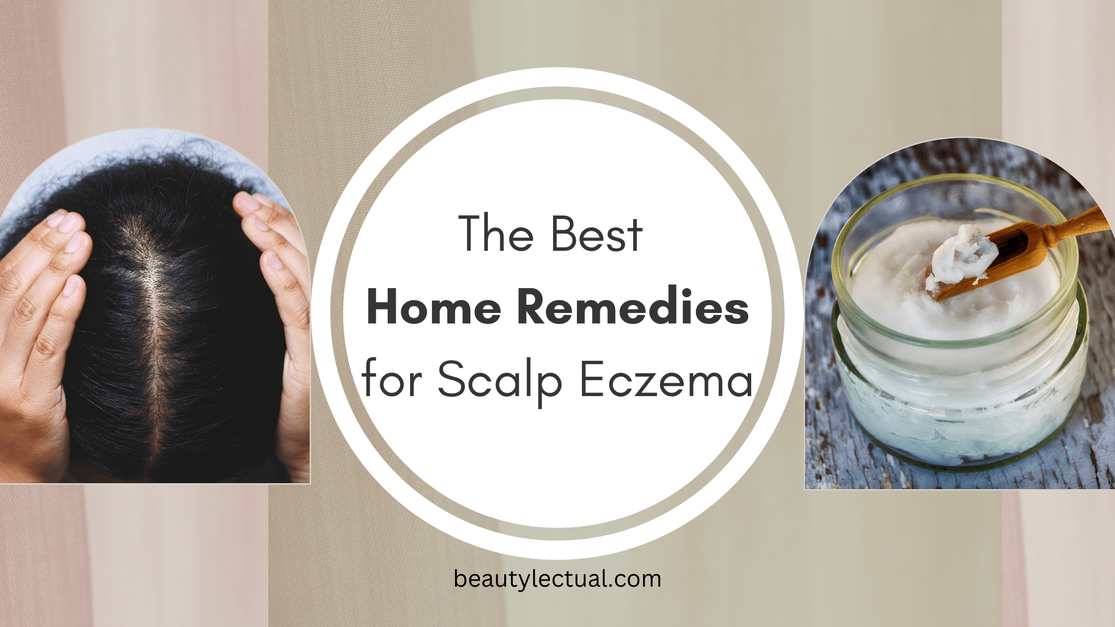 Home Remedies for Scalp Eczema