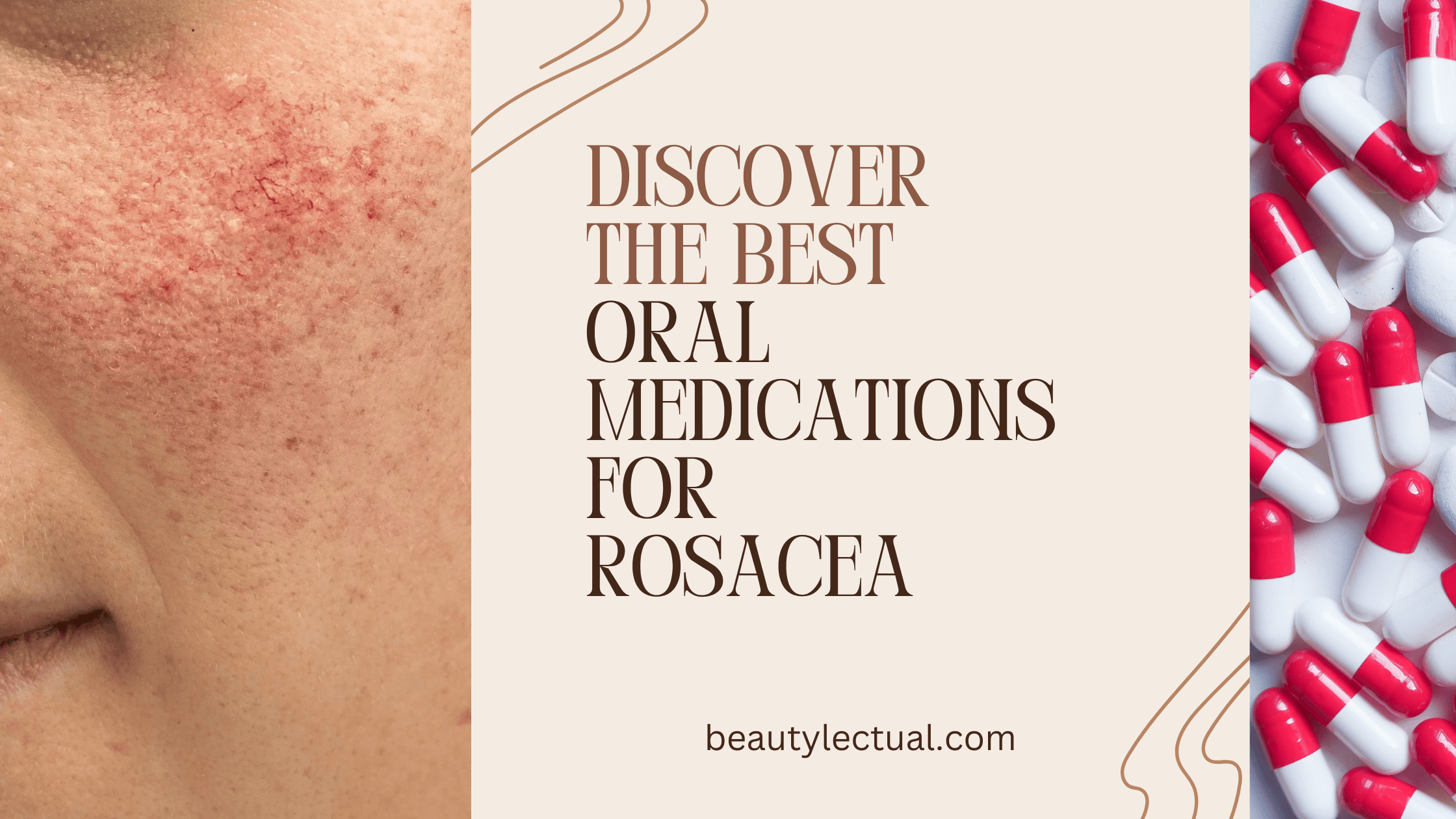 Oral medications for rosacea